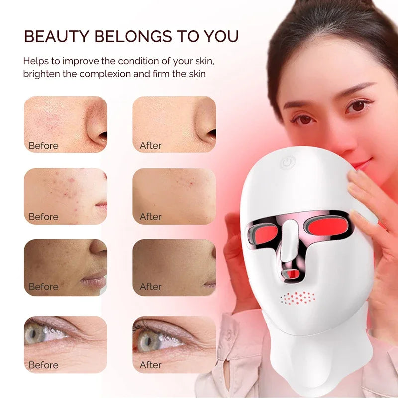 Wireless 7-Color LED Face & Neck Light Therapy Mask